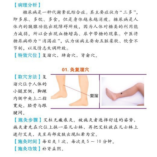 Moxibustion Book Moxibustion Therapy Instruction Manual Moxibustion Equipment Supporting Instructions Caring for Family