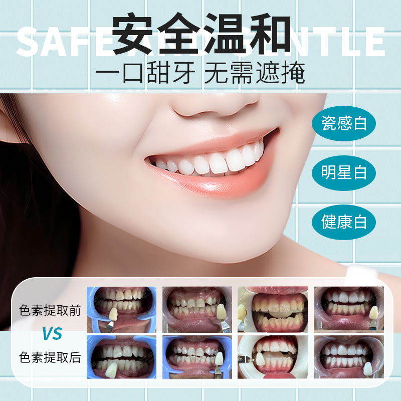 Three Minute Teeth Raw Teeth Pigment Extract Gel Hydrogen Peroxide Teeth Whitening Agent Zhenmei Angel Same Style