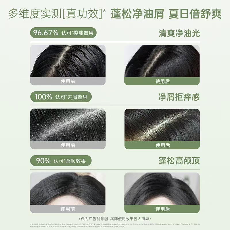 Kangaroo Youth Shampoo for Girls and Boys Special Anti-Dandruff Oil Control Fluffy Anti-Itch Big Boy Shampoo Long-Lasting