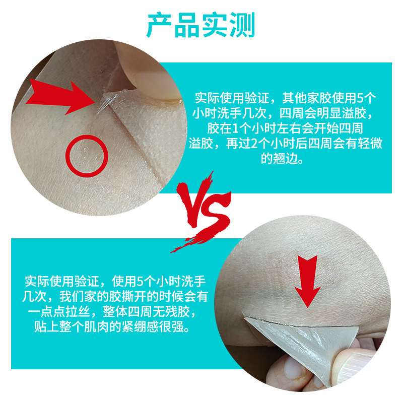 Cross-Border Scar Patch Medical Grade Silicone Processing Postoperative Scar Patch Waterproof and Sweat-Proof Scar Hyperplasia Scar Patch