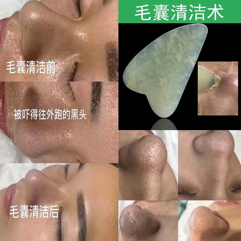 Beauty salon special pore cleansing cream to remove blackheads and acne to clean facial hair follicle dirt clogging facial massage cream