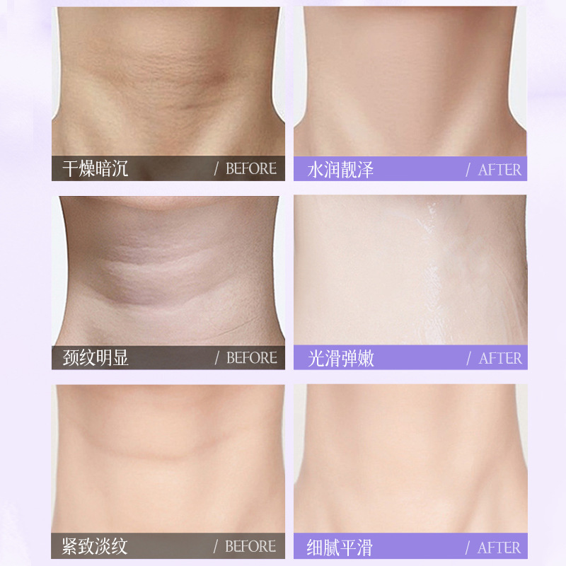 Aopy Polypeptide Firming Neck Mask Lifting Neck Moisturizing Swan Neck Neck Care Neck Line Patch Lightening Neck Mask