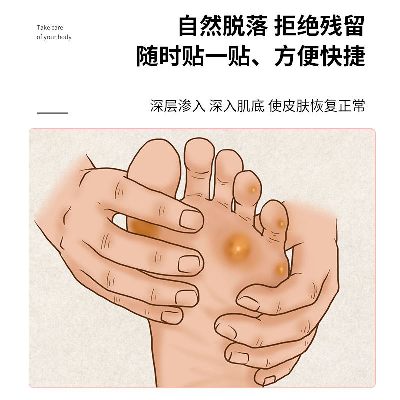 Chicken eye paste manufacturers wholesale to corns foot paste foot care paste chicken eye paste non-woven paste chicken cocoon paste