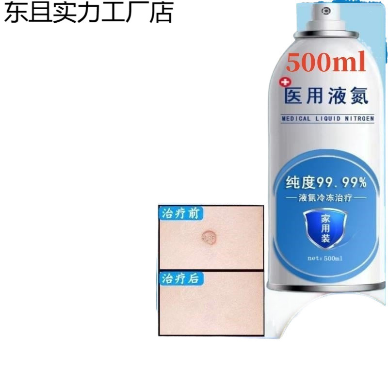 Liquid Nitrogen Freezing to Remove Warts, Remove Corns, Remove Plantar Warts, Liquid Nitrogen Freezing in Small Bottles for Home Use Without Waste