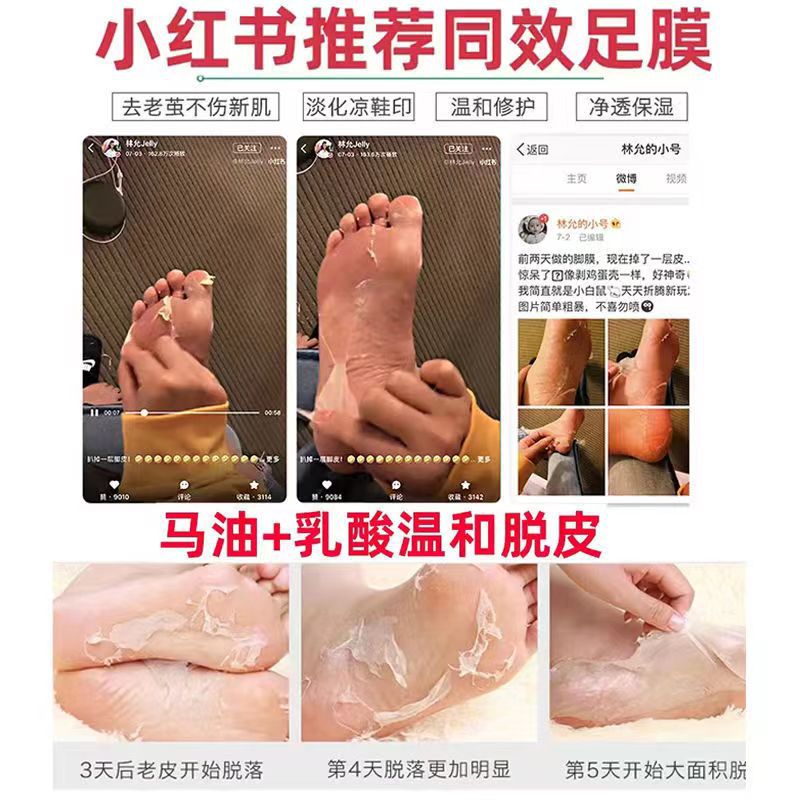 Japanese Same Style Song Bao Lian Horse Oil Foot Mask Gentle Exfoliating Dead Skin Calluses Corneous Chapped Heel Moisturizing Foot Mask