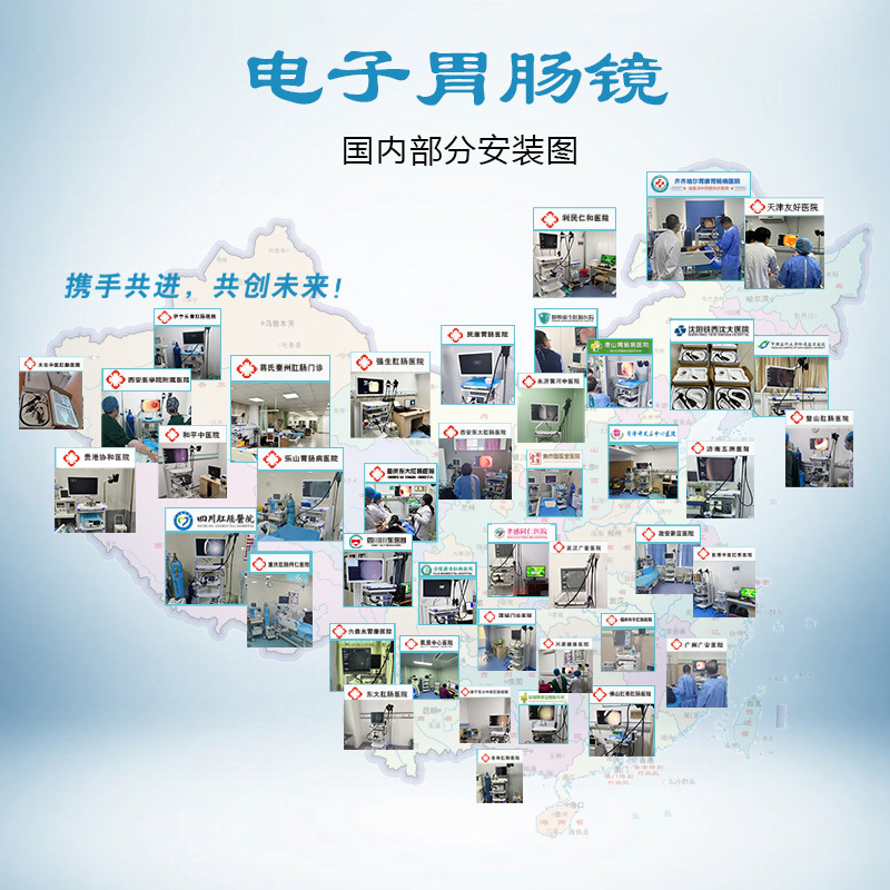 Olympus Electronic Gastrointestinal Endoscope, Electronic Gastroscope and Colonoscope, High-Definition Gastroscope and Colonoscope, Easy to Operate Gastrointestinal Endoscope