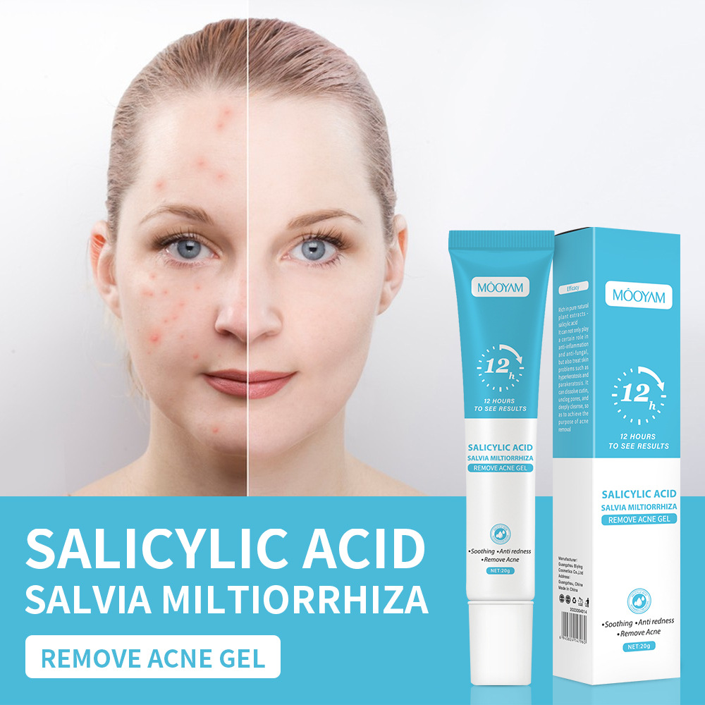 Cross-Border Salicylic Acid Anti-Acne Cream Fades Acne Marks, Removes Acne, Closes Mouth, Shrinks Pores, Plant Essence Anti-Acne Gel