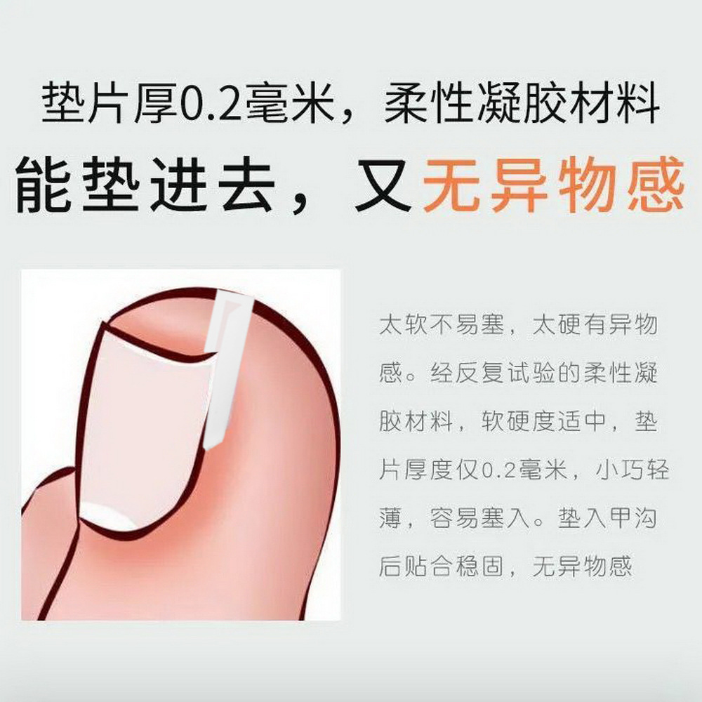 Nail C- type pad nail groove nail inflammation filling gasket corrector nail stick nail nail nail nail nail tie meat artifact