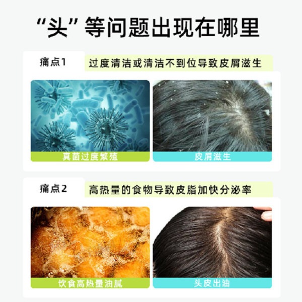 Dual-Chamber Dual-Tube Shampoo with Double-Extract Formula for Scalp Care, Men's Internal and External Use, One-Pump Multi-Material, Oil Control, and Anti-Hair Loss