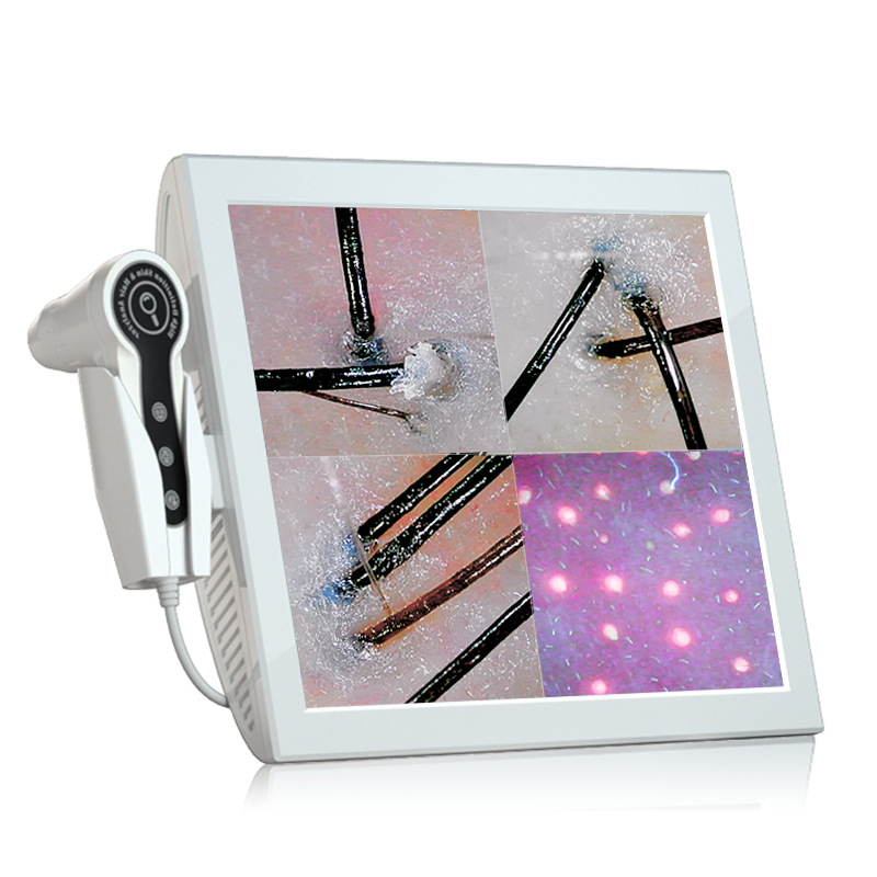 15-inch four-compartment scalp detector HD all-in-one machine intelligent hair follicle hair analyzer skin detector