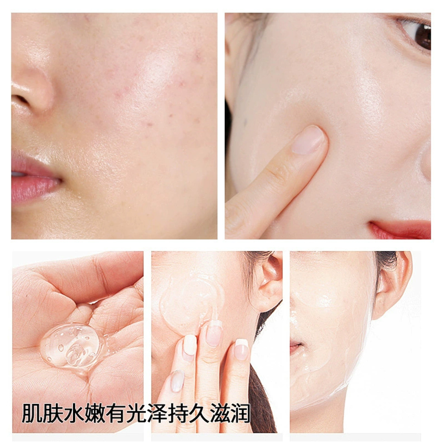 Beauty Salon Aloe Vera Gel Skin Filling Set Curacao Facial Care Soothing Skin Aloe Vera Skin Filling Spa Wholesale