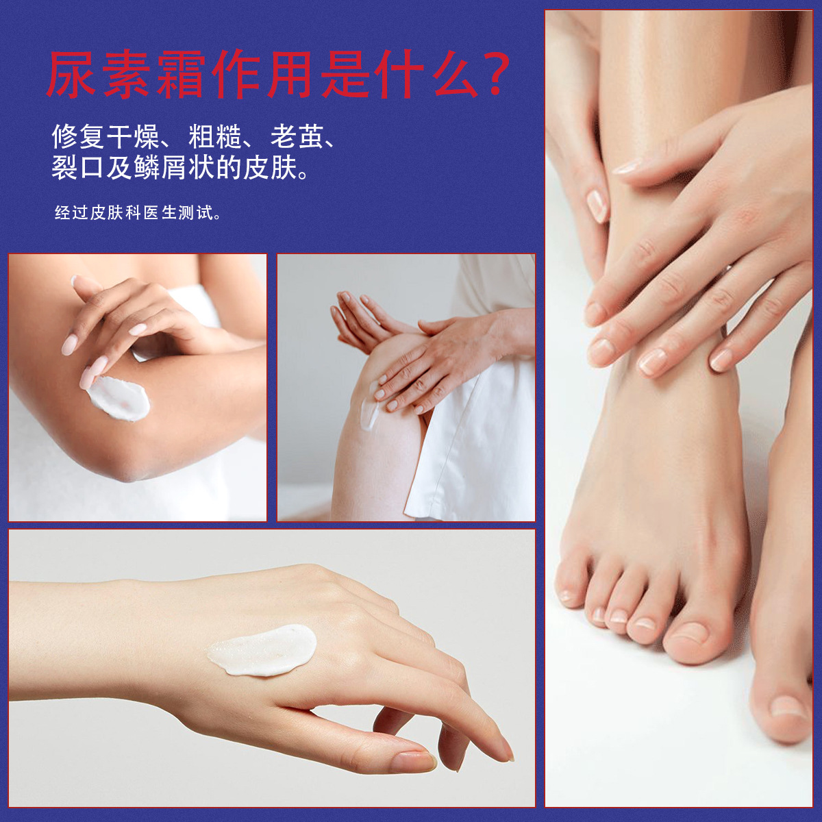 Cross-Border Urea Cream 40% Vitamin E Exfoliation, Anti-Drying, Anti-Cracking, Moisturizing and Moisturizing Manufacturer Hand and Foot Care Cream