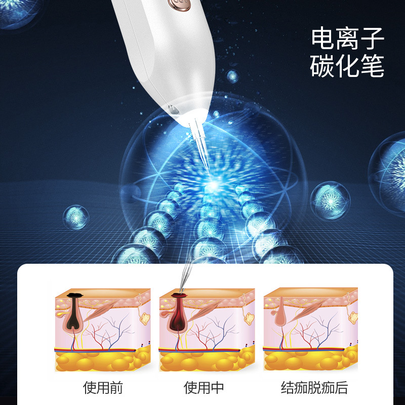 Cross-Border Popular Lcd Mole Removal Pen for Home Use, Beauty Salon Special Small White Spot Removal Pen, Laser Beauty Mole Removal Instrument