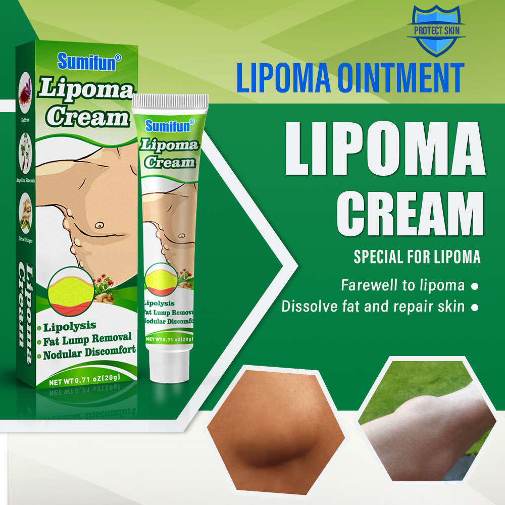 Sumifun Lipoma Cream Cross-border Lipoma Kang Cream Skin Moulds K10069