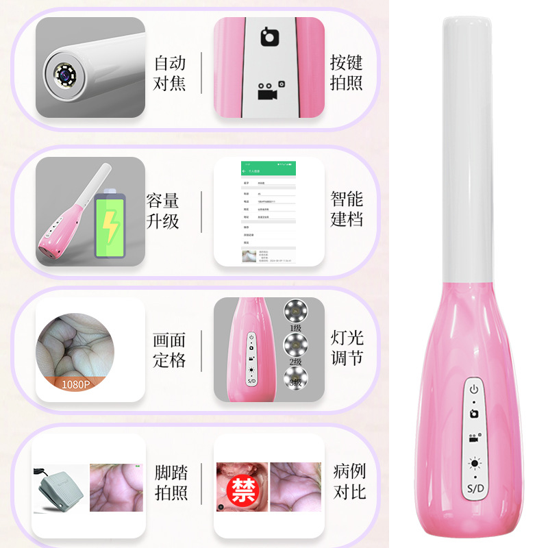 Vaginal Endoscope Visual Gynecological Examination Device Electronic High-Definition Camera Without Dilating the Vagina Cervical Instrument Wide-Angle