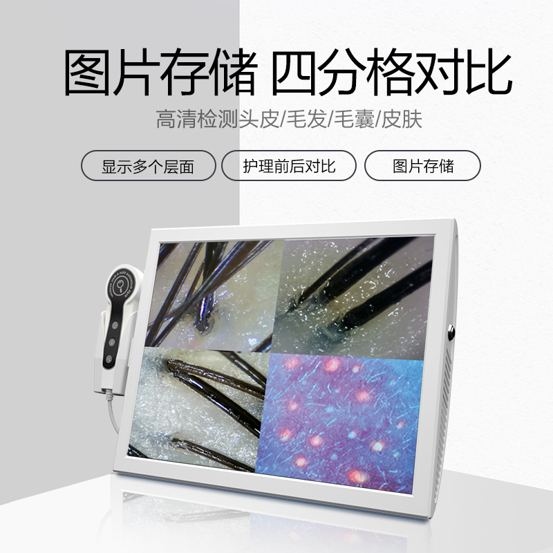 15-inch four-compartment scalp detector HD all-in-one machine intelligent hair follicle hair analyzer skin detector