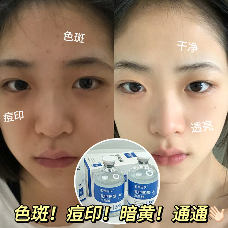 [Delivery Within 48 Hours] [Tik Tok Hot Style] 5% Tranexamic Acid Wet Compress Hydrating Essence for Dull Pigment