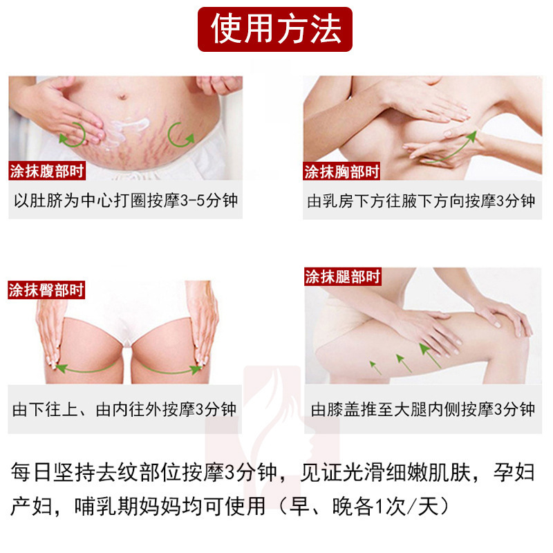 Stretch Mark Repair Cream, Postpartum Repair, Stretch Mark Removal, Obesity Mark Reduction, Growth Mark Tightening, Slimming, Scar Relief