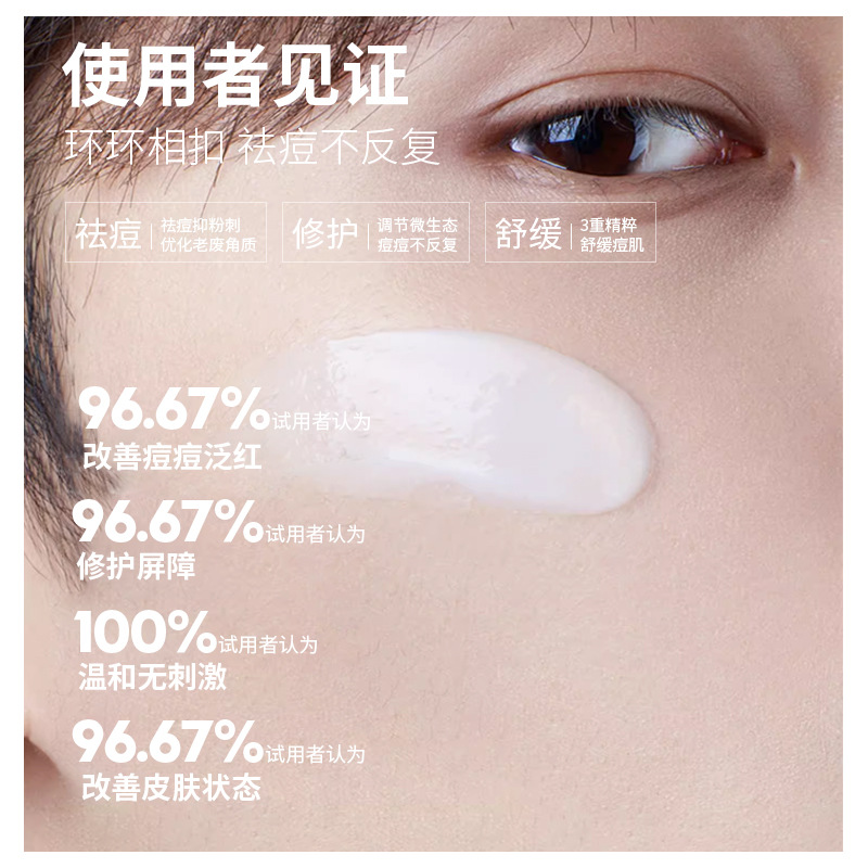 Jewel Men's Anti-Acne Repair Energy Milk Oil Control Cream Moisturizing Face Skin Care Products Autumn and Winter