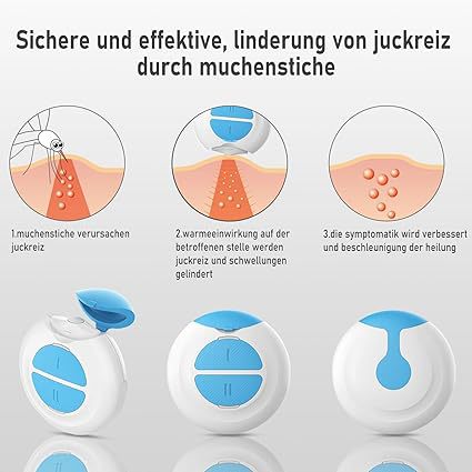 Insect Bite Treatment USB Charging, Mosquito Bite Heat Pen Treatment Relieve Itching Amazon