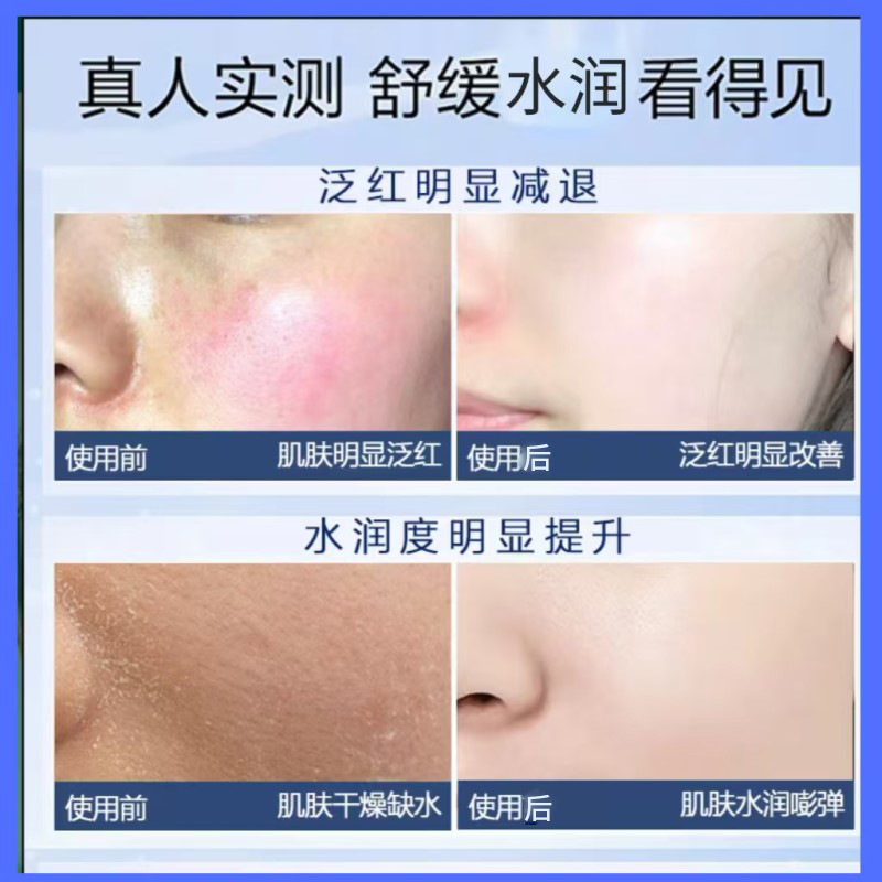 Blue Copper Peptide Freeze-Dried Powder Kit 10ml Travel Size for Sensitive and Acne-Prone Skin, Repairs Barrier, 80,000 Units, Ready Stock, Hydrating