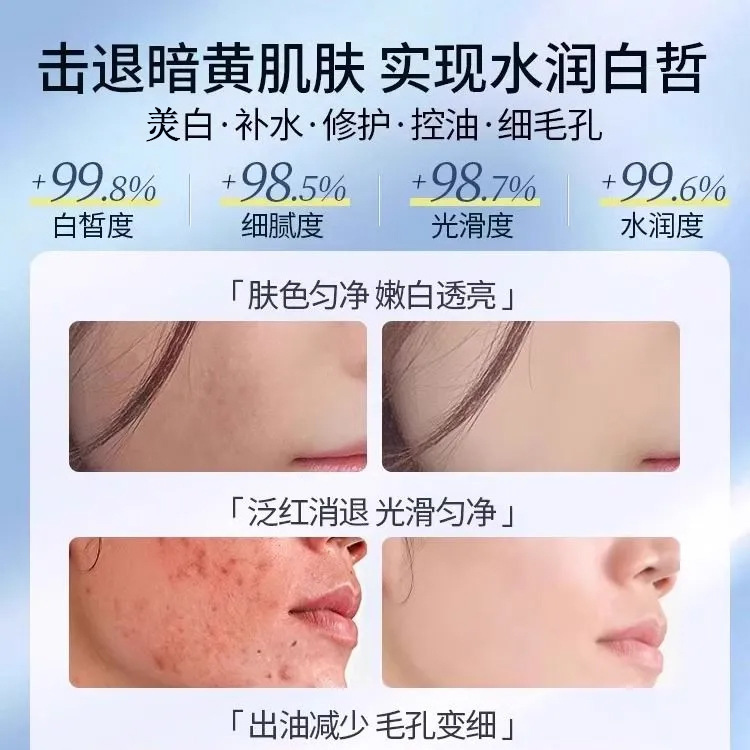 Skin Care Products, Lotion Set, Moisturizing, Hydrating, Brightening, Diluting Acne Marks, Shrinking Pores, Firming Skin Set Wholesale