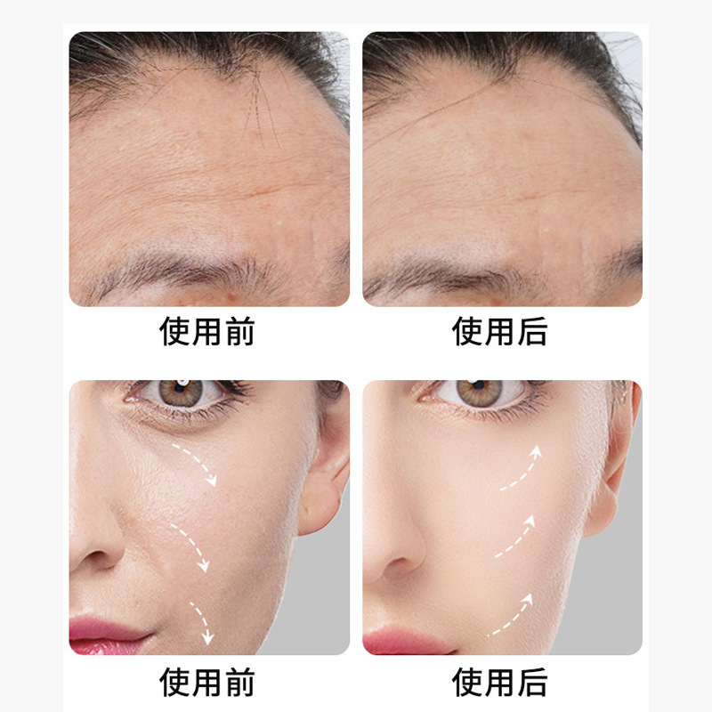 Foreign Trade Model Desktop Tt Mantis Knife Precision Carving Ultrasonic Ring-Shaped Dotting Beauty Salon Special Instrument for Skin Rejuvenation and Beauty