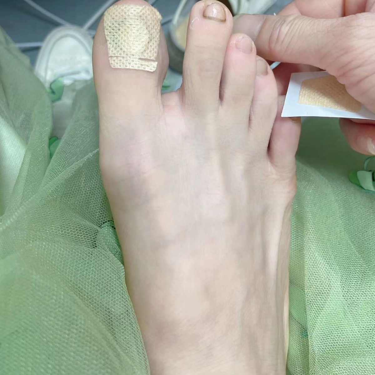 Cross-Border Spot Glue-Free Nail Stickers, Toenail Stickers, Pull-Up Stickers, Nail Stickers, Nail Repair Nail Groove Correction Stickers