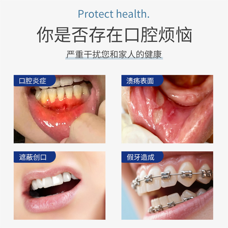 Shunamei Oral Ulcer Gargle Relieves Oral Ulcer Oral Inflammation and Pain Mouthwash Protects Wurt