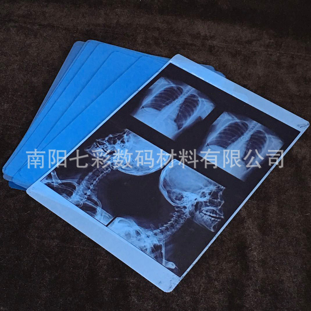 Factory wholesale A4 medical blue base inkjet printing film Blue inkjet radiology department orthopedic pet printing film