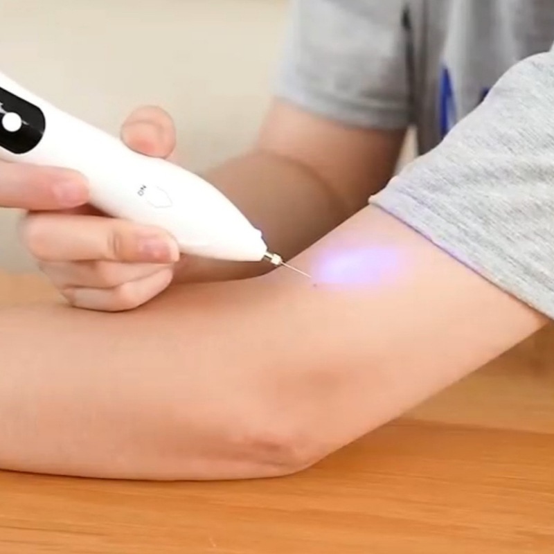 Household New Beauty Salon Special Painless Mole Spot Pen Small White Freckle Pen Lcd Laser Mole Spot Pen