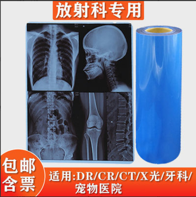 Full BoX Price Chongze DRy Blue-based Film Radiation DR CT X Light Film Nuclear Magnetic Resonance Tooth Film Inkjet Blue Film