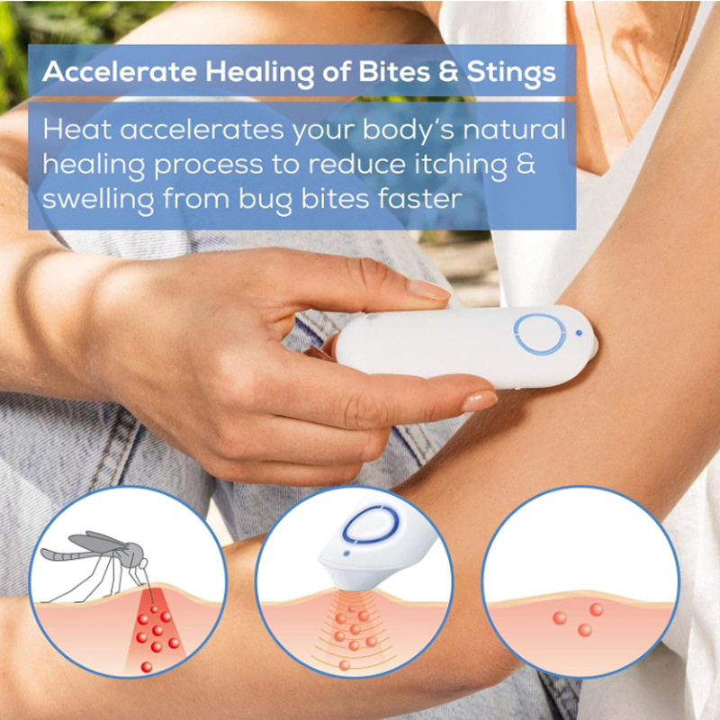 New Household Mosquito Antipruritic Apparatus Baby Mosquito Antipruritic Quick Antipruritic Apparatus for Children Physical Antipruritic Apparatus