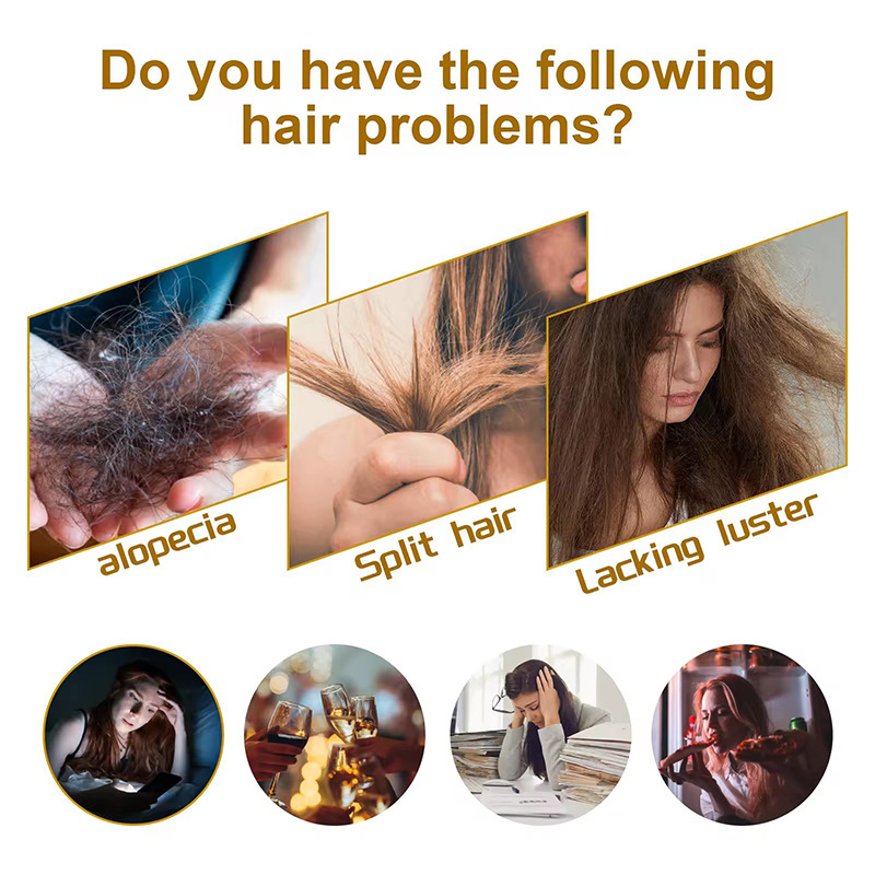 Foreign trade explosions hair spray VIGOROUS HAIR TONIC improve frizzy hair growth hair liquid