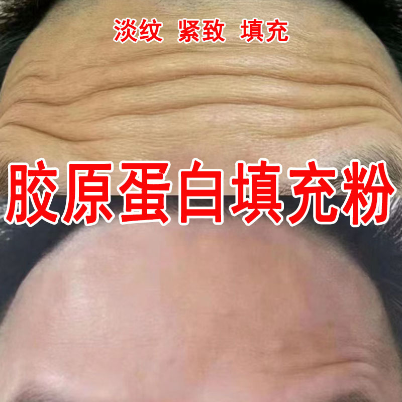 Порошок коллагена для удаления носогубных складок, мелких морщин, уплотнения и против морщин