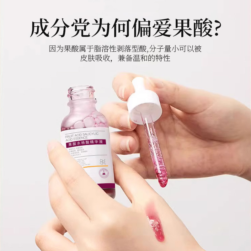 Zhenyan fruit acid salicylate essence improve acne removing acne closed Pore Blackhead acne removing essence wholesale
