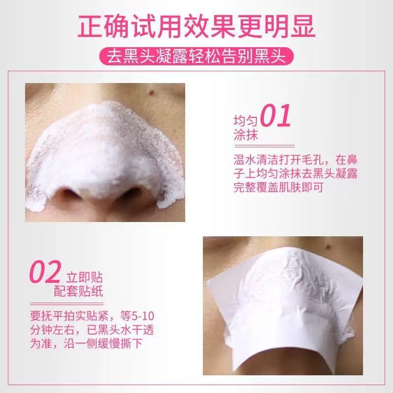 Thailand White Blackhead Removal Nose Sticker Tear Blackhead Removal Acne Cleaning Nose Sticker genuine goods Aloe Vera Gel Blackhead Sticker