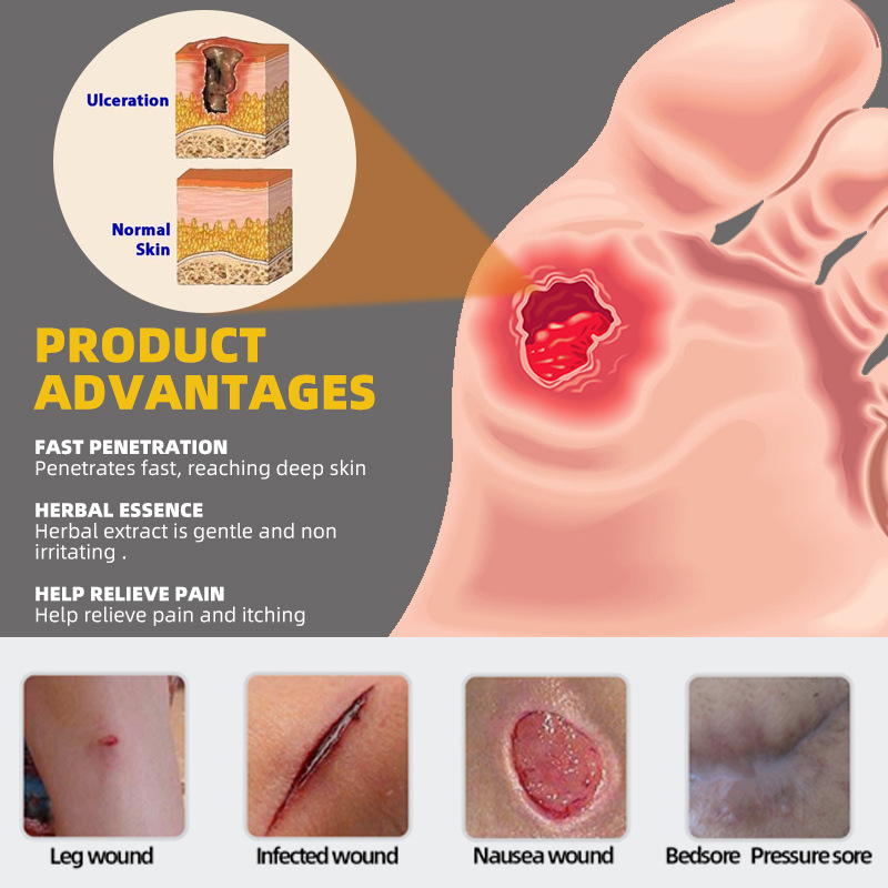 Sumifun Aliexpress Amazon Temu Cross-Border Bedsore Cream Pressure Sore Care Elderly Health K10110