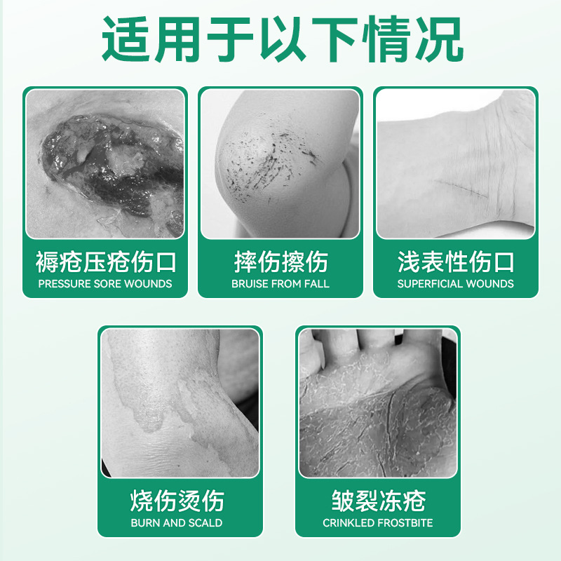 Toneng Pharmaceutical Silver Ion Disinfectant Gel Damaged Skin Disinfection Decubitus Antibacterial Promotes Healing Anxin Brand