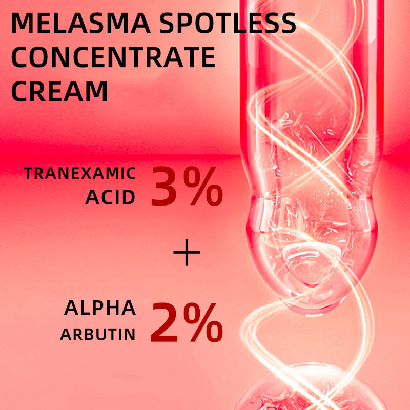 BARUBT Cross-border Chloasma Whitening Concentrate Anti-freckle Cream Spot Lightening Fading Spot Chloasma Freckles