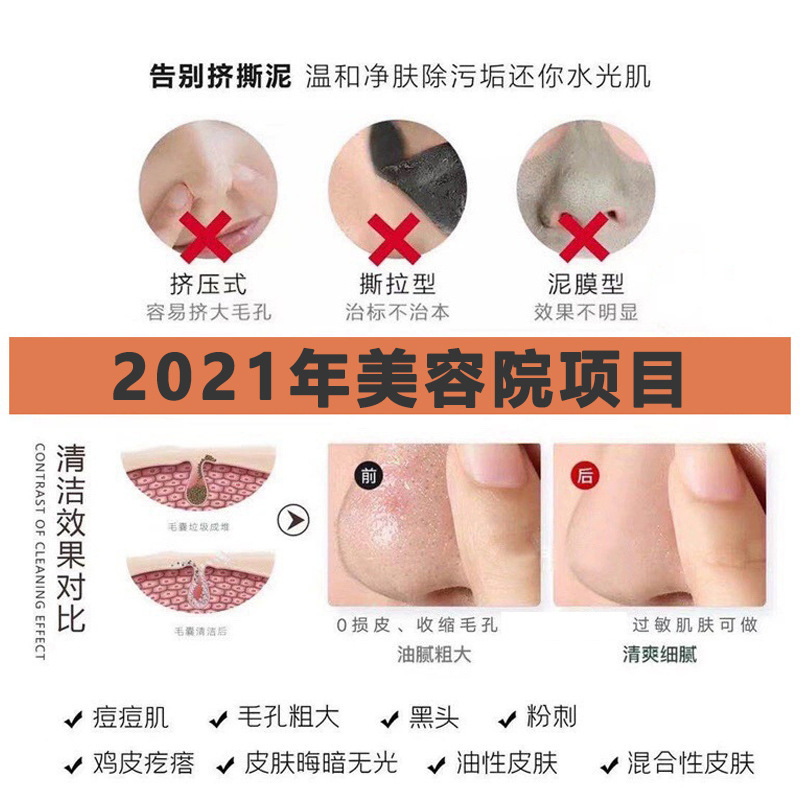 Hair Follicle Cleansing Cream, Purifying Cream, Beauty Salon Specializes in Shrinking Pores, Deep Cleansing Cream, Removing Blackheads, Facial Massage Cream