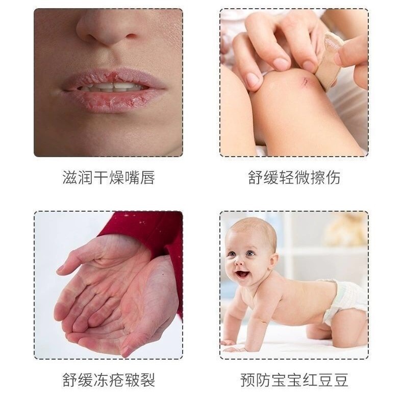 Wool Fat Cream Nipple Chapped Cream Newborn Breast-feeding Cream Breast-feeding Pain Pregnant Women Skin Care Chapped Repair Sheep Fat