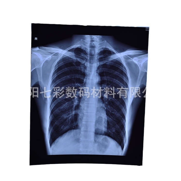 Factory wholesale A4 medical blue base inkjet printing film Blue inkjet radiology department orthopedic pet printing film