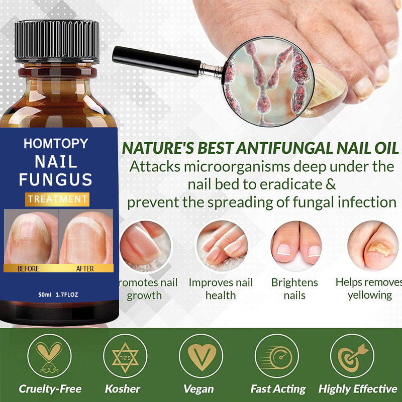 Cross-border new nail fungus repair nourishing liquid bright nail essence cleaning nail repair essence