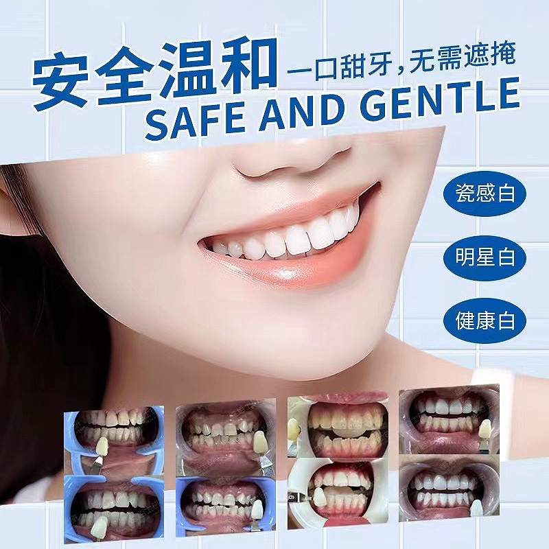 3 minutes restore white teeth original teeth pigment extract beauty teeth brightening white gel source factory direct sales 3 minutes effective