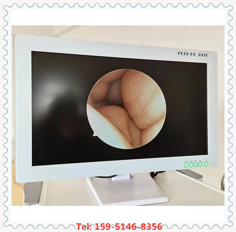 Wholesale Ear Nose Throat Low Temperature Plasma Ear Nose Throat Endoscope Imaging System Cold Light Source Monitor Camera