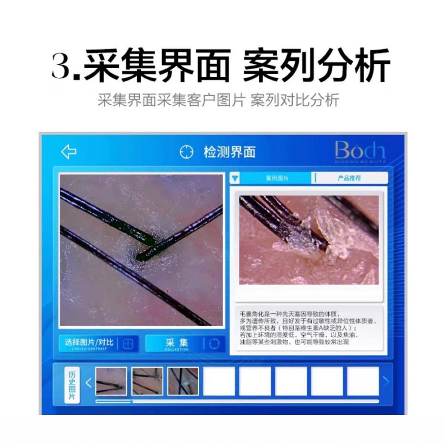 15inch Intelligent Ai Scalp and Skin Analyzer New Model Hair Follicle Skin Tester with High-Definition Built-In Analysis