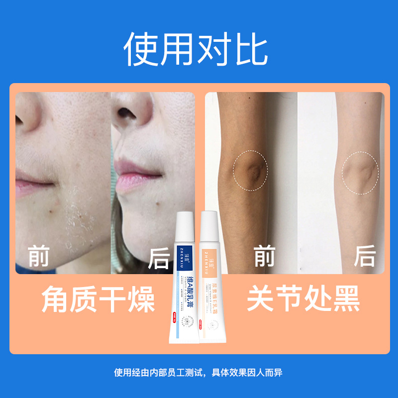 Upgraded Version of Vitamin a Lactobion Vitamin E Cream Moisturizing, Smoothing, Hydrating, Shrinking Pores, Diluting Acne Marks, Skin Care for Students