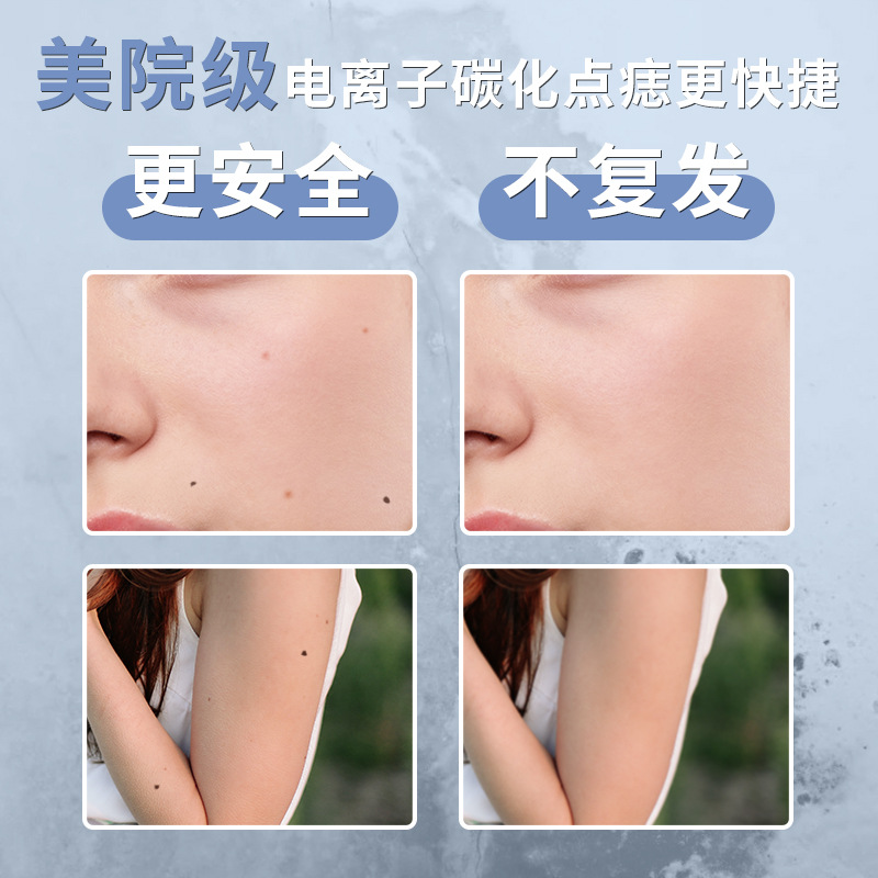 Cross-Border Popular Mole Spot Pen, Household Mole Removal Laser Spot Scanning Pen, Beauty Electric Ion Freckle Remover, Small White Spot Mole Pen
