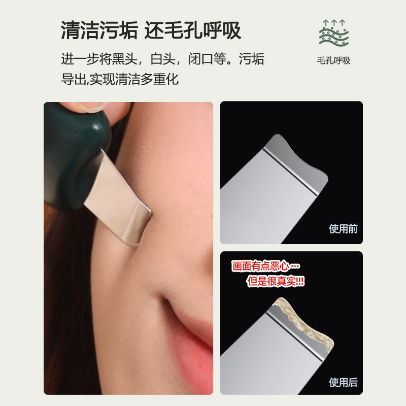 2023 Cross-Border Beauty Device, Skin Scraping Machine, Acne Removal Device, Facial Pore Cleansing Instrument, Ultrasonic Scalpel, Portable Skin Scraping Device